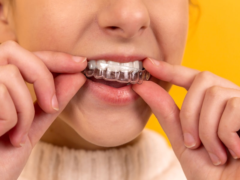Orthodontic Care
